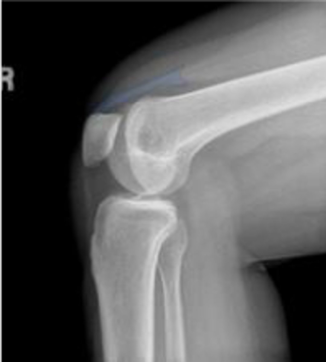 <p>What is outlined?</p>