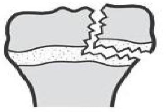 <p>what type of fx is this?</p>