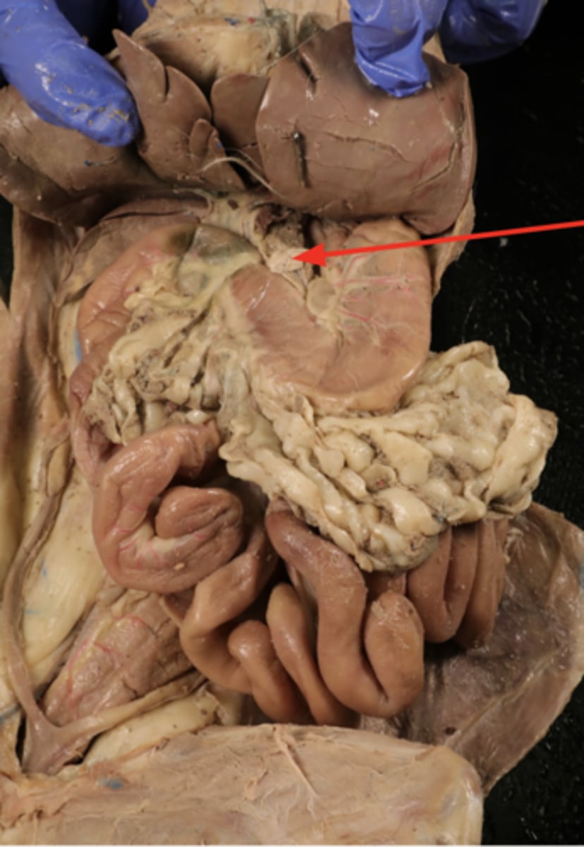 <p>attaches stomach to liver</p>