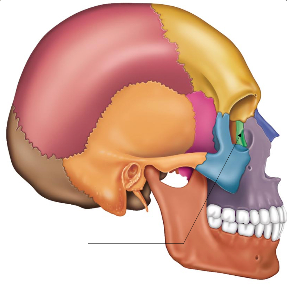 term image