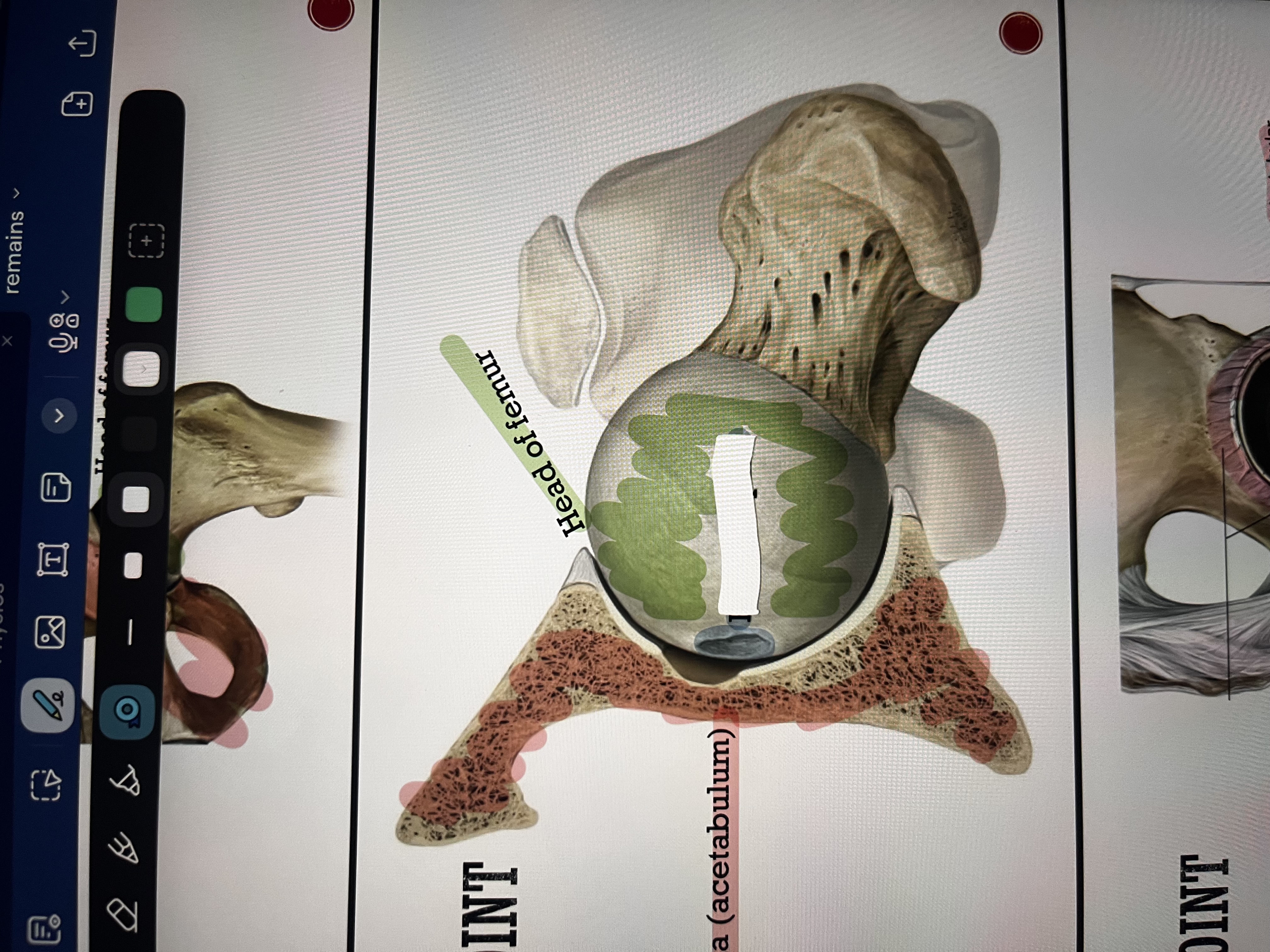 <p>name the little bump in the femur head </p>