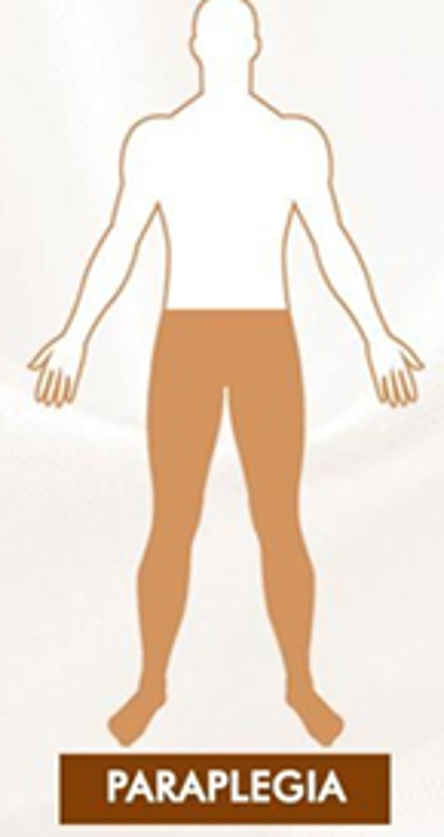 <p>Hind limbs are affected</p><p>denerative conditions (disk rupture) trauma, vascular, tumor</p>
