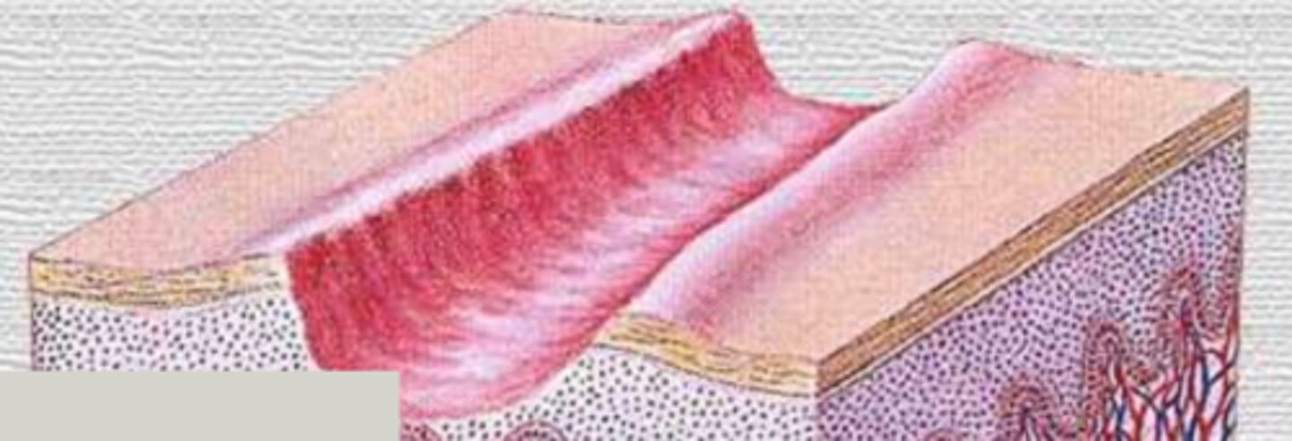 <p>¿lesión?</p><p>¿primaria o secundaria?</p>