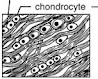 <p>What type of cartilage is shown in the picture?</p>