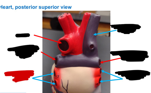 <p>Name this heart vessel</p>