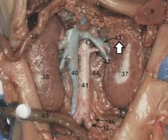 <p>What is the arrow pointing to? What’s it function? </p>