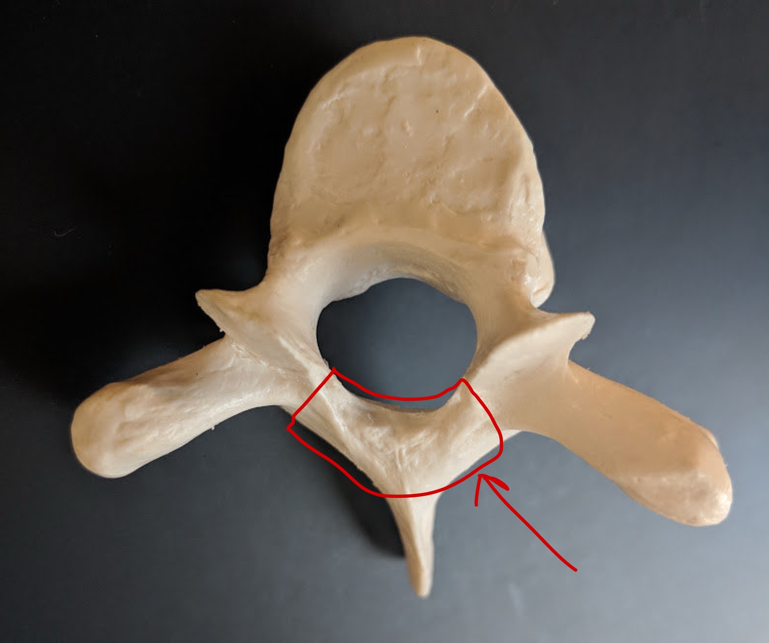 <p>Name this structure</p>