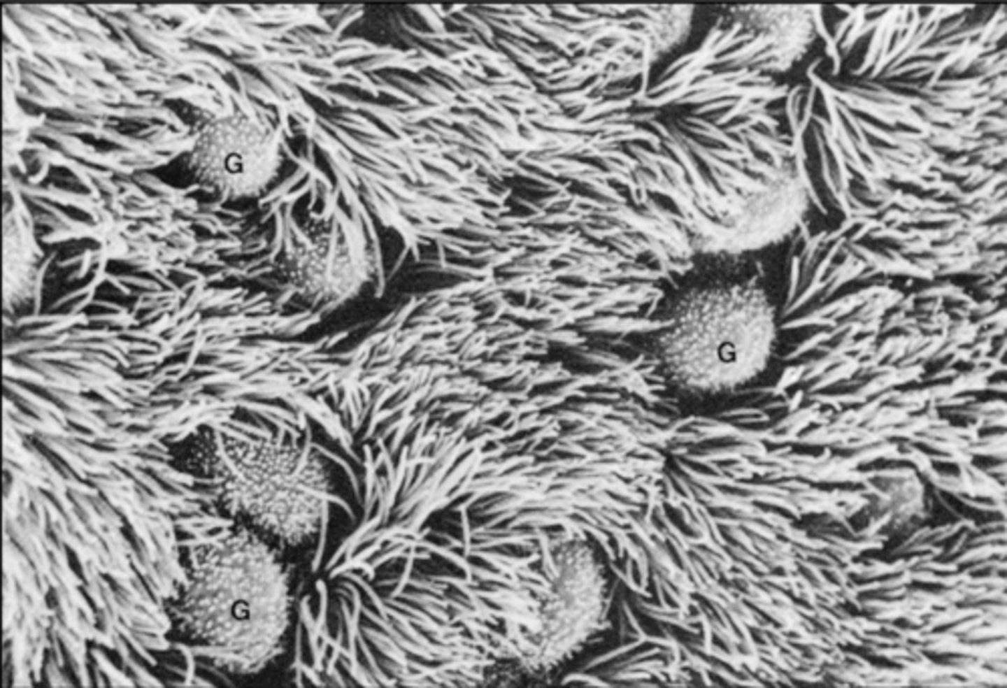 <p>ID the epithelium:</p>
