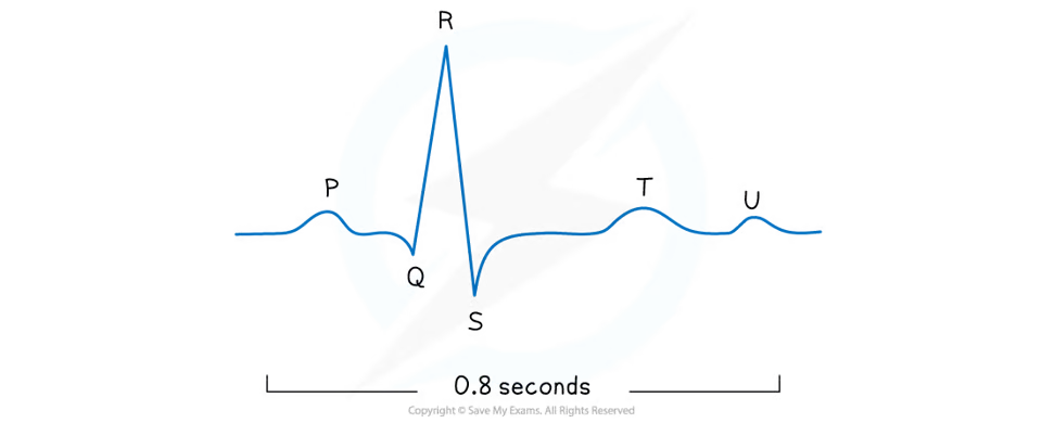 <ul><li><p>P wave:</p><ul><li><p>depolarisation of atria, resulting in atrial systole</p></li></ul></li><li><p>QRS complex:</p><ul><li><p>depolarisation of ventricles, resulting in ventricular systole</p></li><li><p>largest→ ventricles have largest muscle mass</p></li></ul></li><li><p>T wave:</p><ul><li><p>repolarisation of ventricles→ ventricular diastole</p></li></ul></li><li><p>U wave:</p><ul><li><p>uncertainty→ repolarisation of Purkyne fibres?</p></li></ul></li></ul>