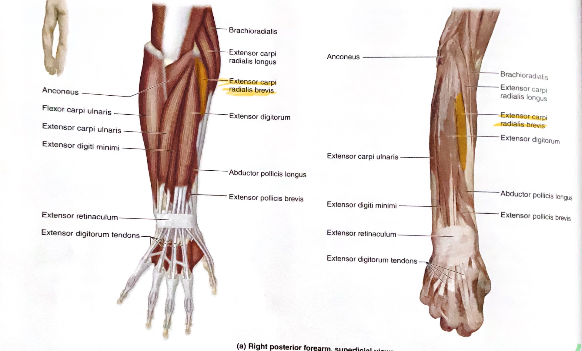 <p>Action: Extend, abduct wrist </p>