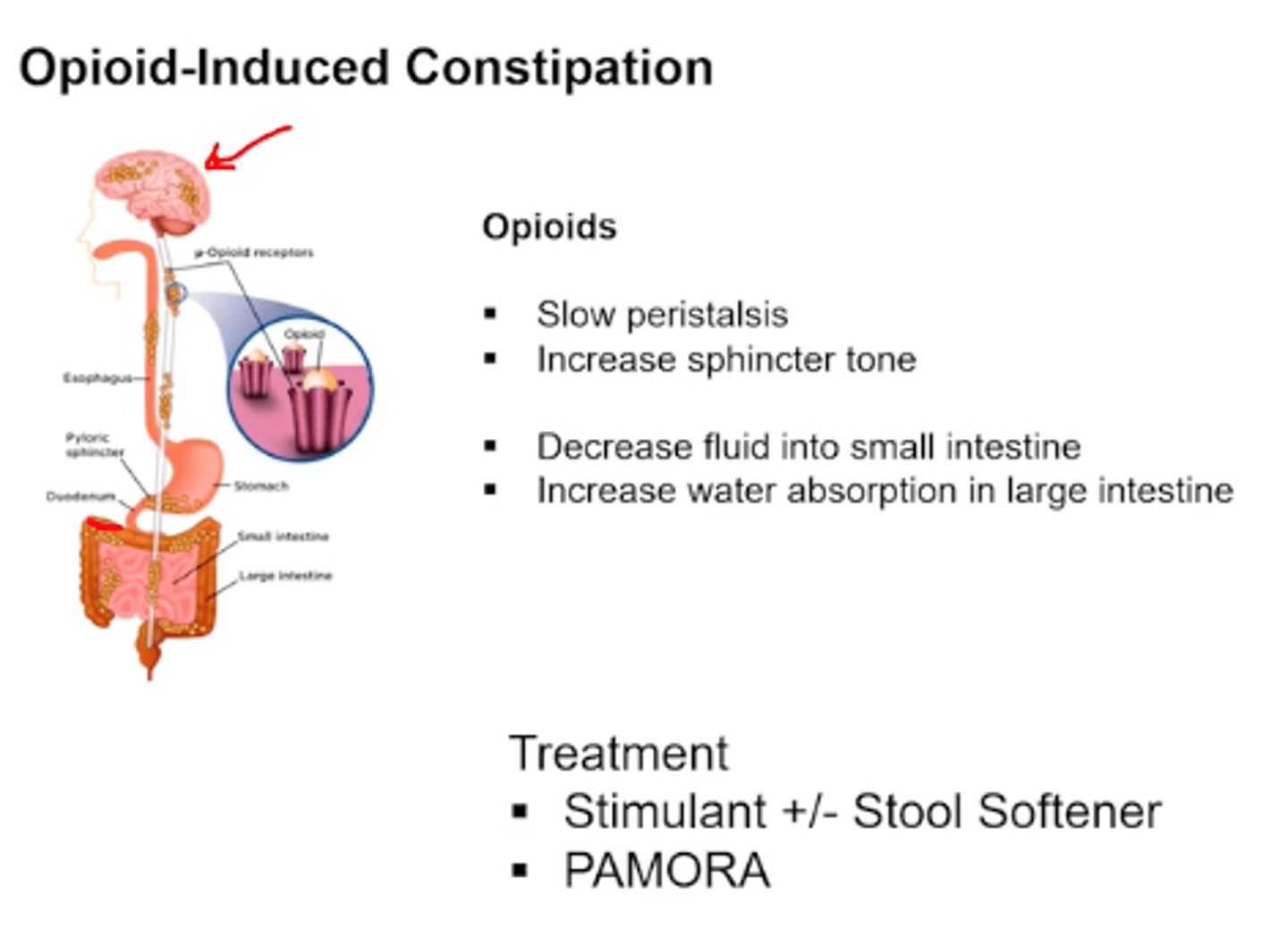 <p>- assess bowel function BEFORE initiating therapy</p><p>- 1st line: non-pharm therapy + OTC stimulant/osmotic laxatives</p><p>- 2nd line: peripherally acting mu opioid receptor antagonists (PAMORA)</p><p>- generally avoid stool softeners: problem is not that the stool is hard, it is that the bowels are not contracting</p>