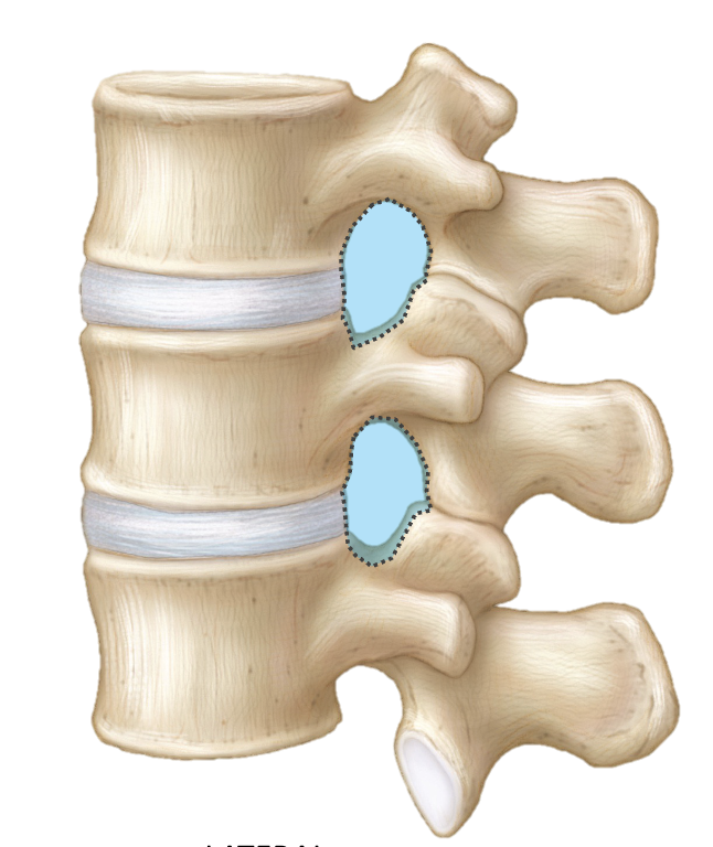 <p><span><span>a lateral opening or "doorway" between two adjacent vertebrae, located on both sides of the spinal column, which acts as a passageway for spinal nerves and blood vessels to exit the spinal cord</span></span></p>