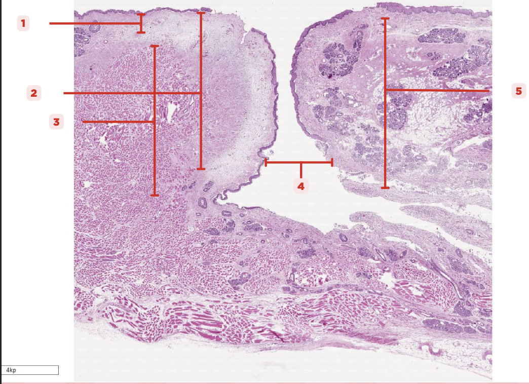 <p>Space that separates the true and false vocal cords (#4)</p>