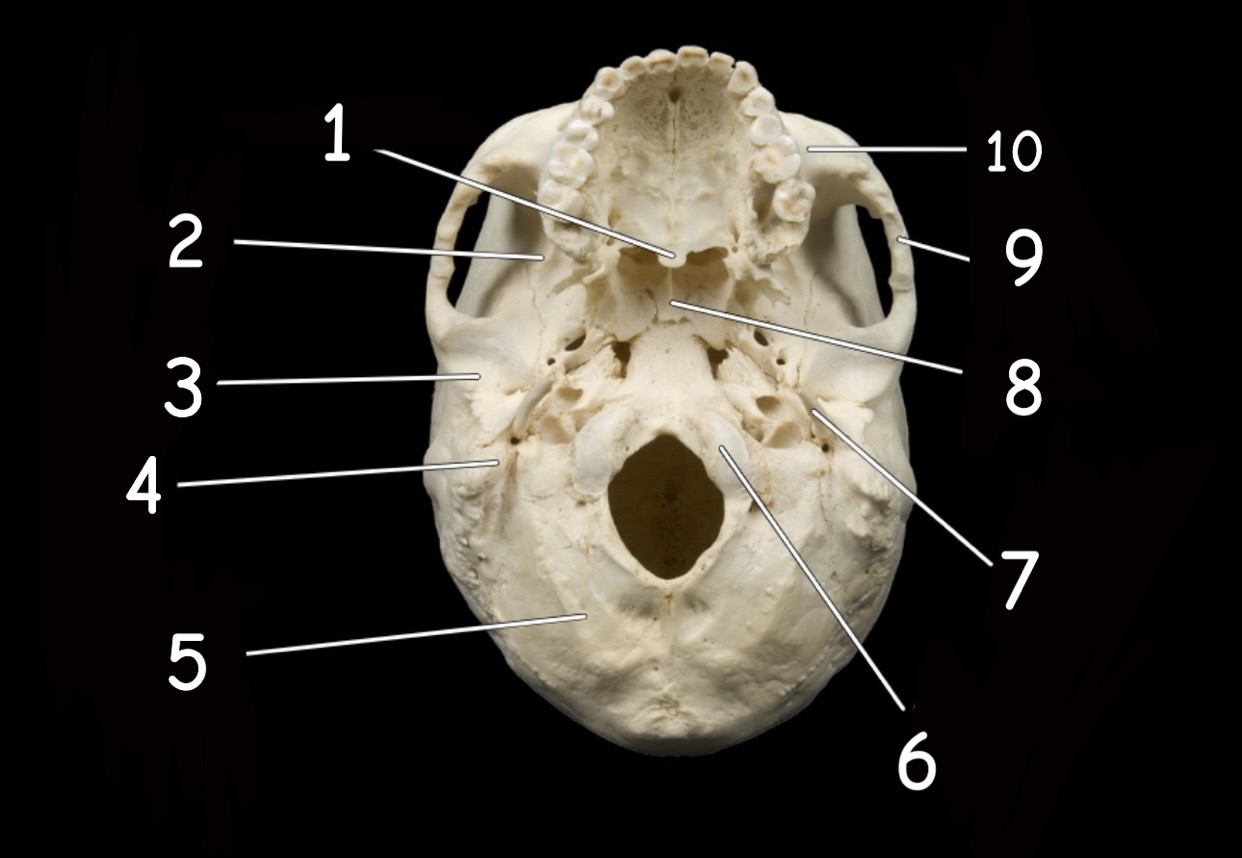 term image