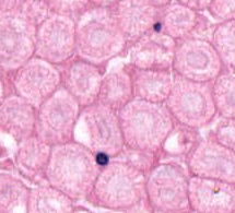 <p>non-myelinated and myelinated axons of different diameters seen in cross section </p>