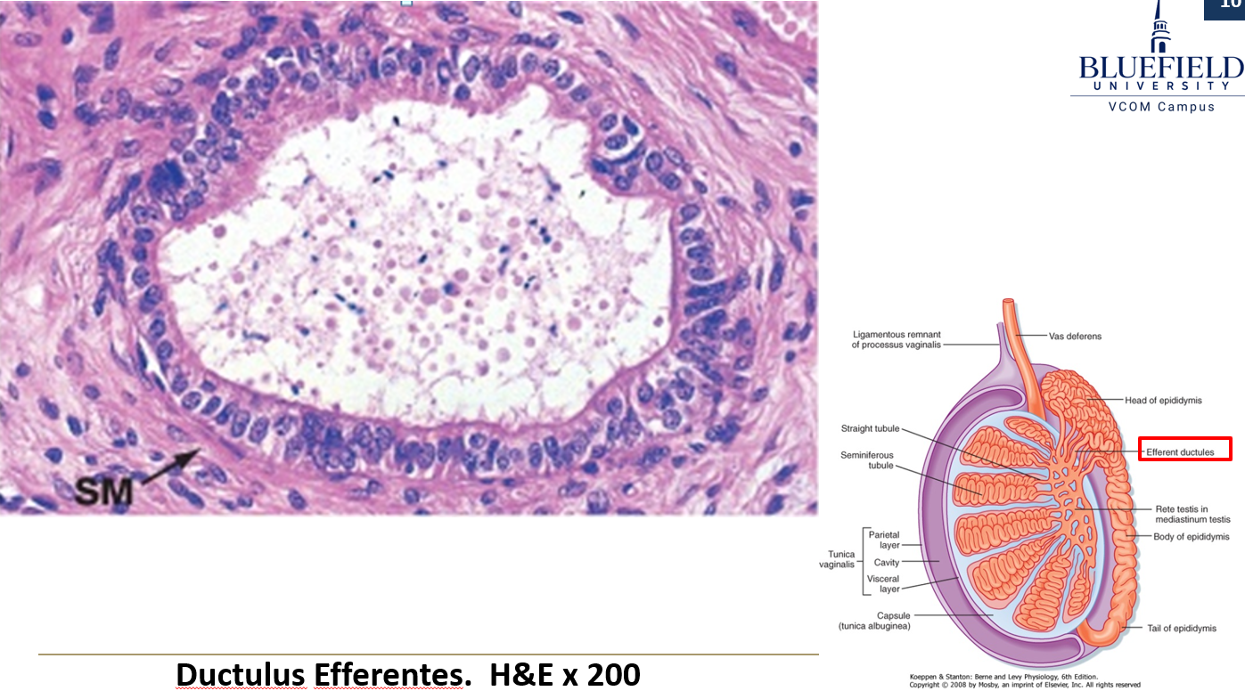<p><strong>Alternating cuboidal and columnar epithelium</strong>, creating a <strong>folded appearance</strong>.</p>
