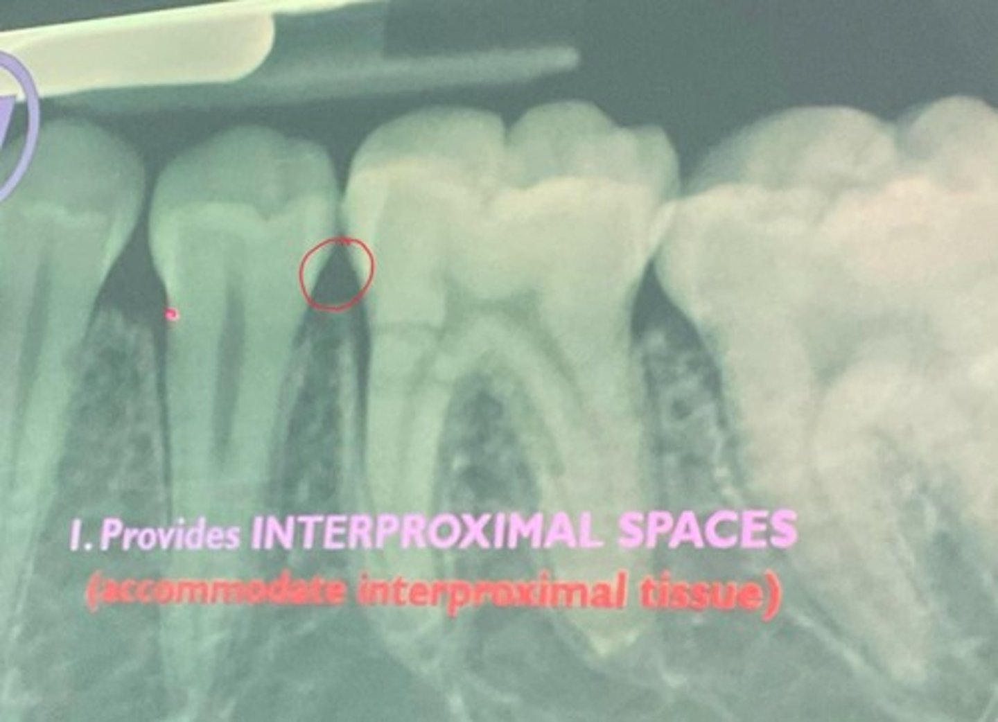 <p>it fills interproximal spaces and covers part of the cervical third of the tooth crowns</p>