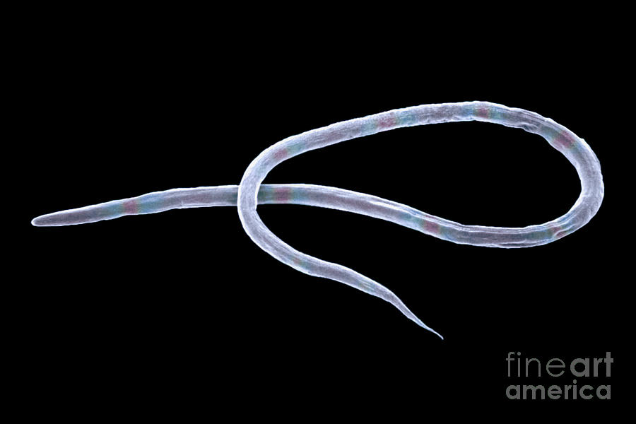 <p>Vinegar eel (<em>Turbatrix aceti)</em></p>