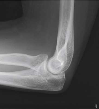 <p>What projection, position, and anatomy is this?</p>