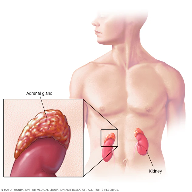 <p>Originates from <strong>neural crest cells </strong>that normally develop into the <strong>adrenal medulla </strong></p>