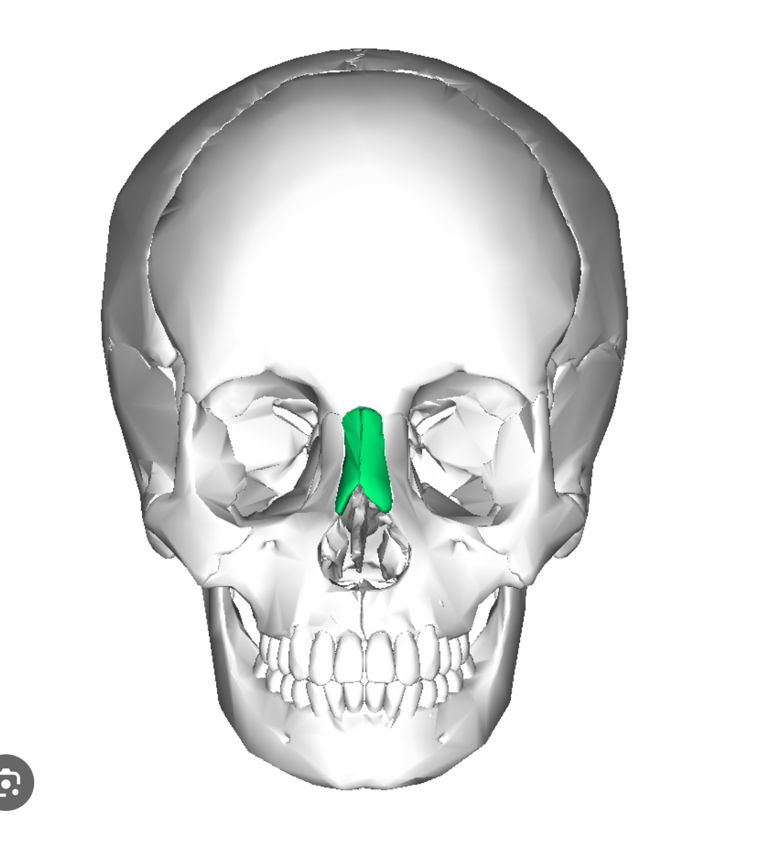 <p>Nasal bone (left and right)</p>