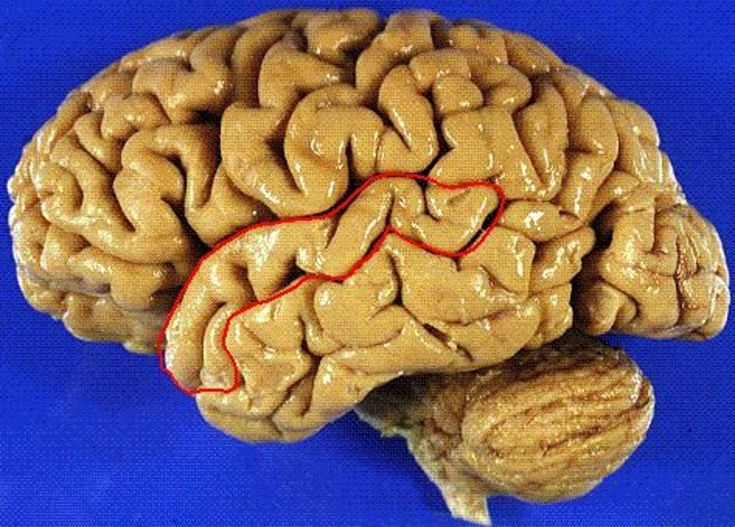 <p>nearest to the lateral fissure. location of the primary auditory cortex.</p>