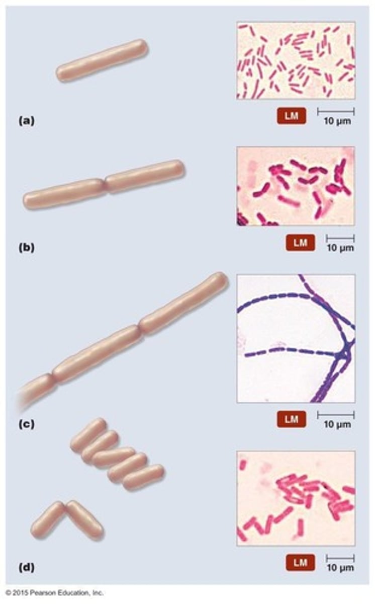 <p>Bacilli arranged in pairs.</p>