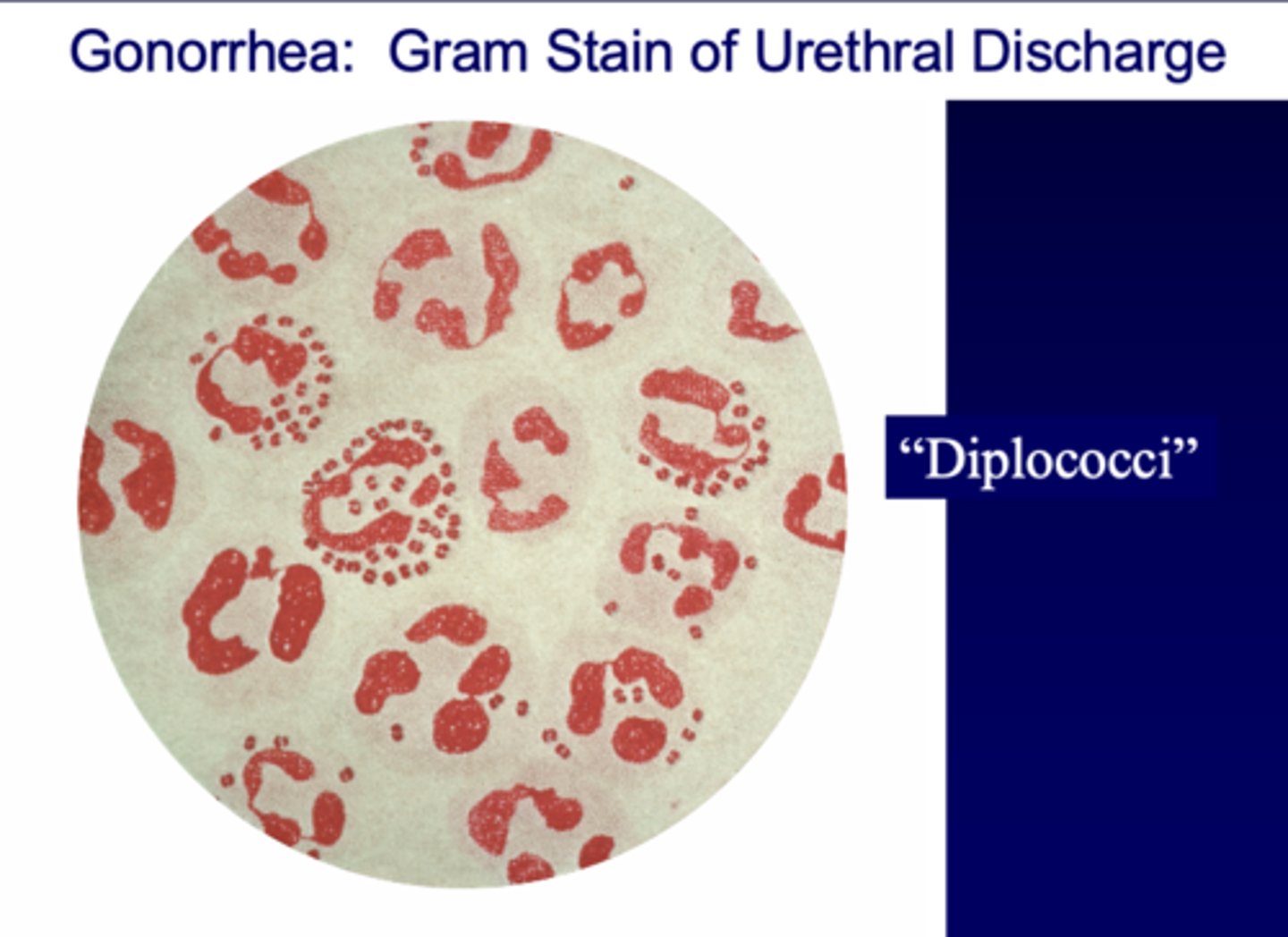 <p>Neisseria gonorrhoeae</p>