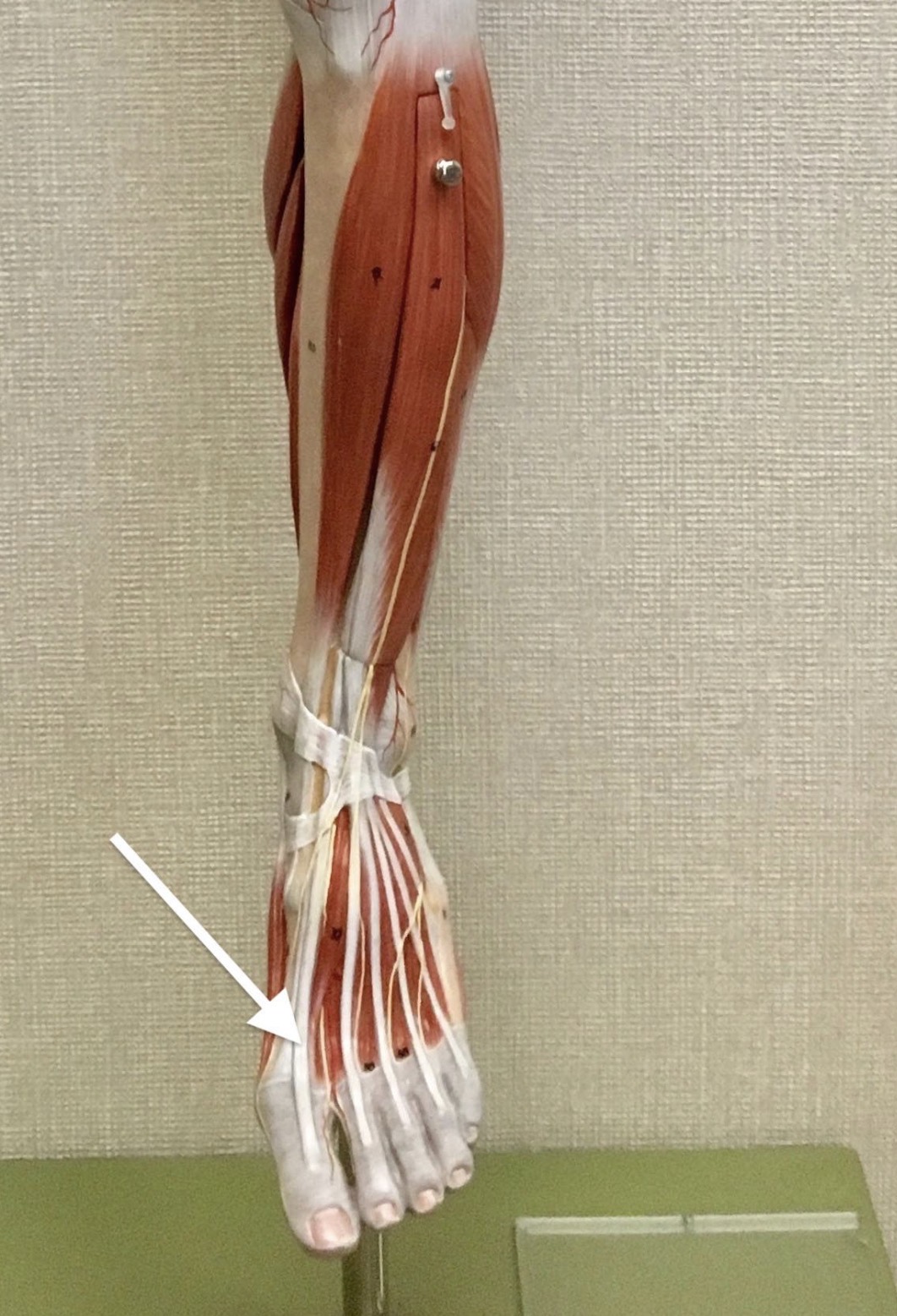 <p><span>Name the muscle labeled with the white arrow below:</span></p>