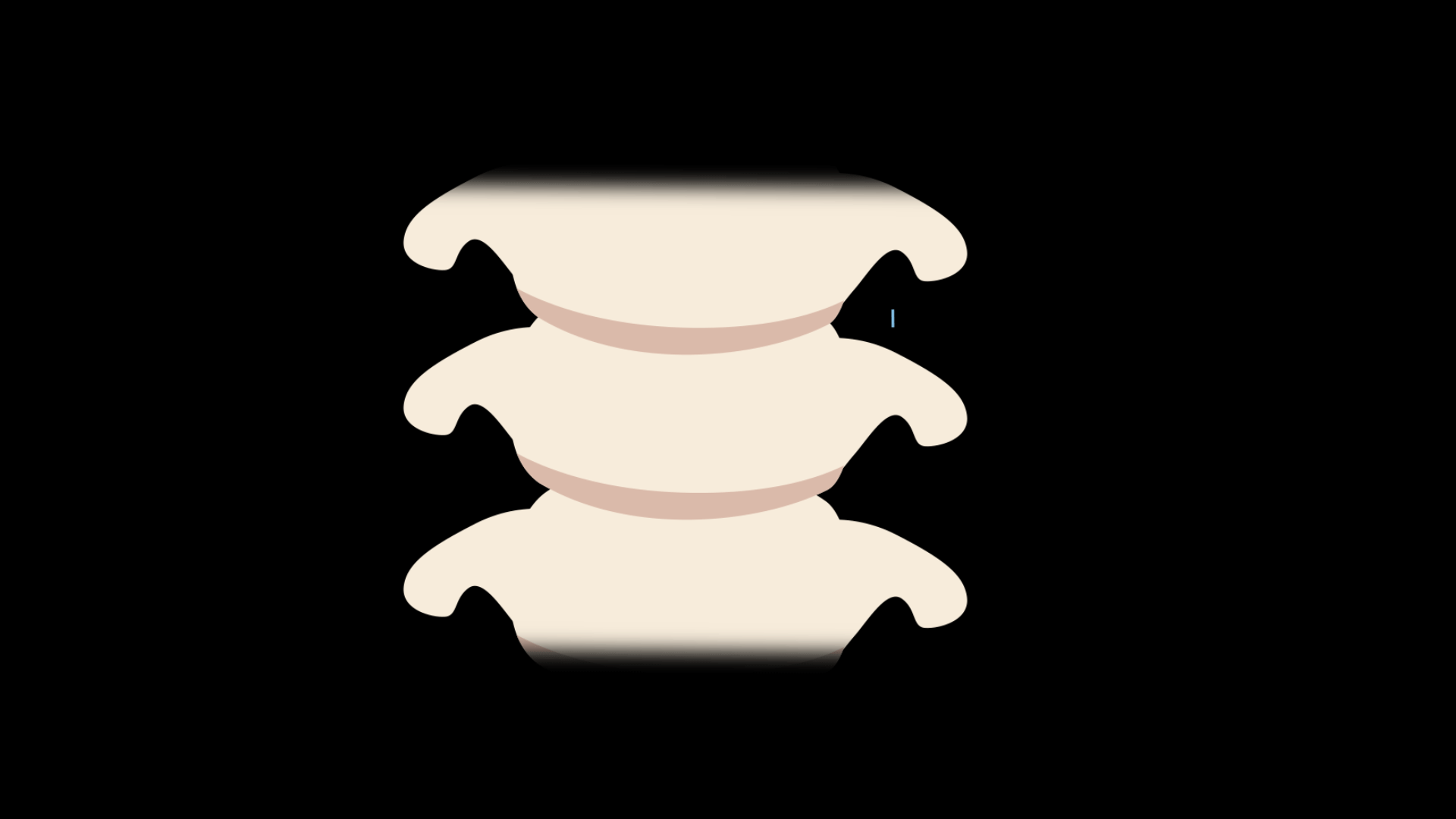 <p>Joints that only allow for a gliding movement in a sliding motion, like those depicted in the image. One example is the intercarpal joints in the wrist.</p>