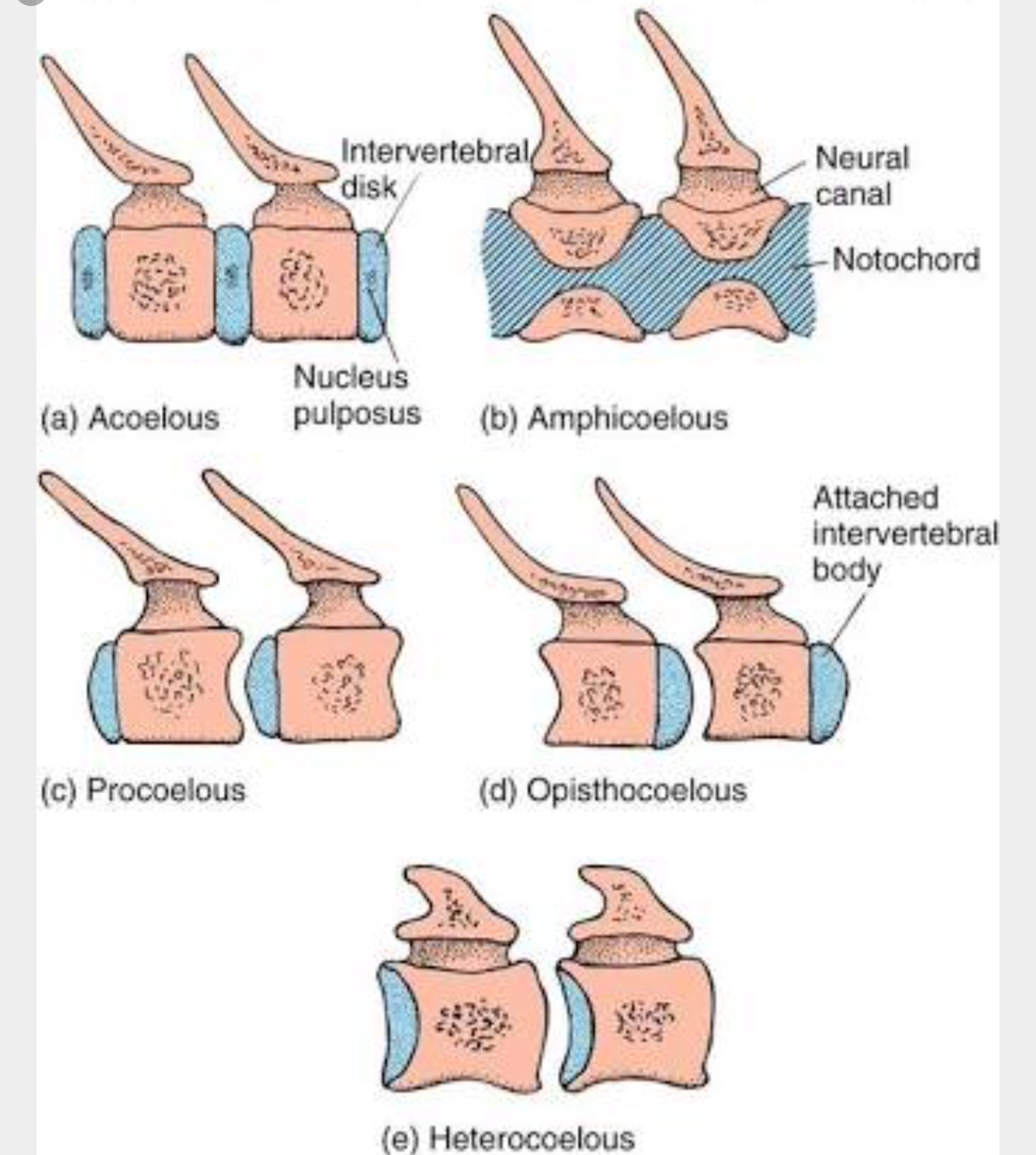 <p>Both ends concave</p>
