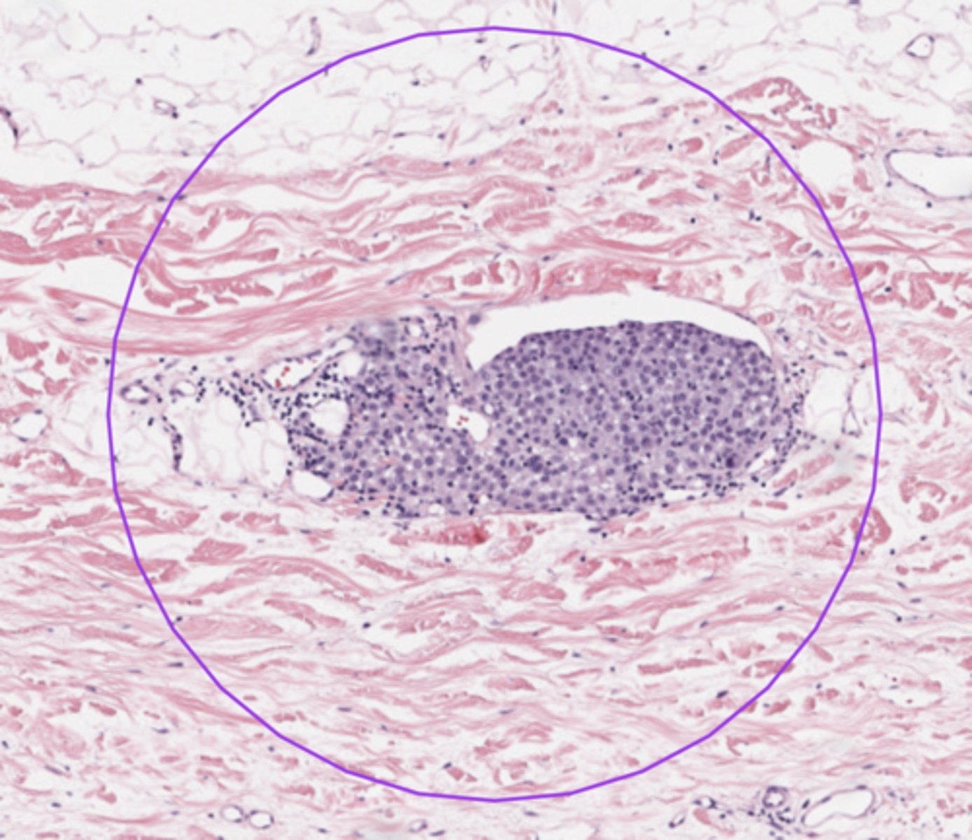 <p>Skin</p>