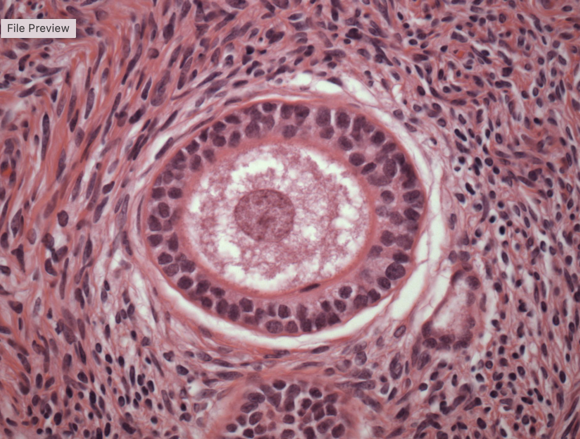 term image