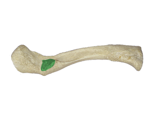 <p>What is the green portion called?</p>