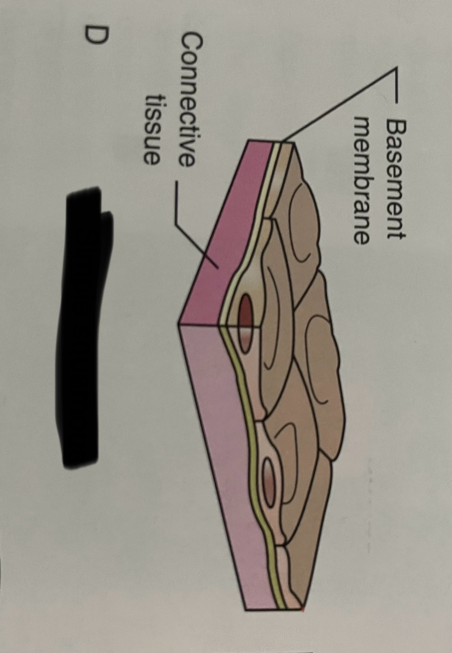 <p>what type of layering is this?</p>