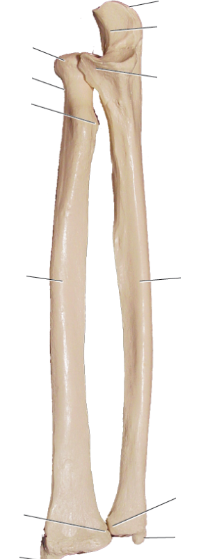 <p>Right or left pair</p>