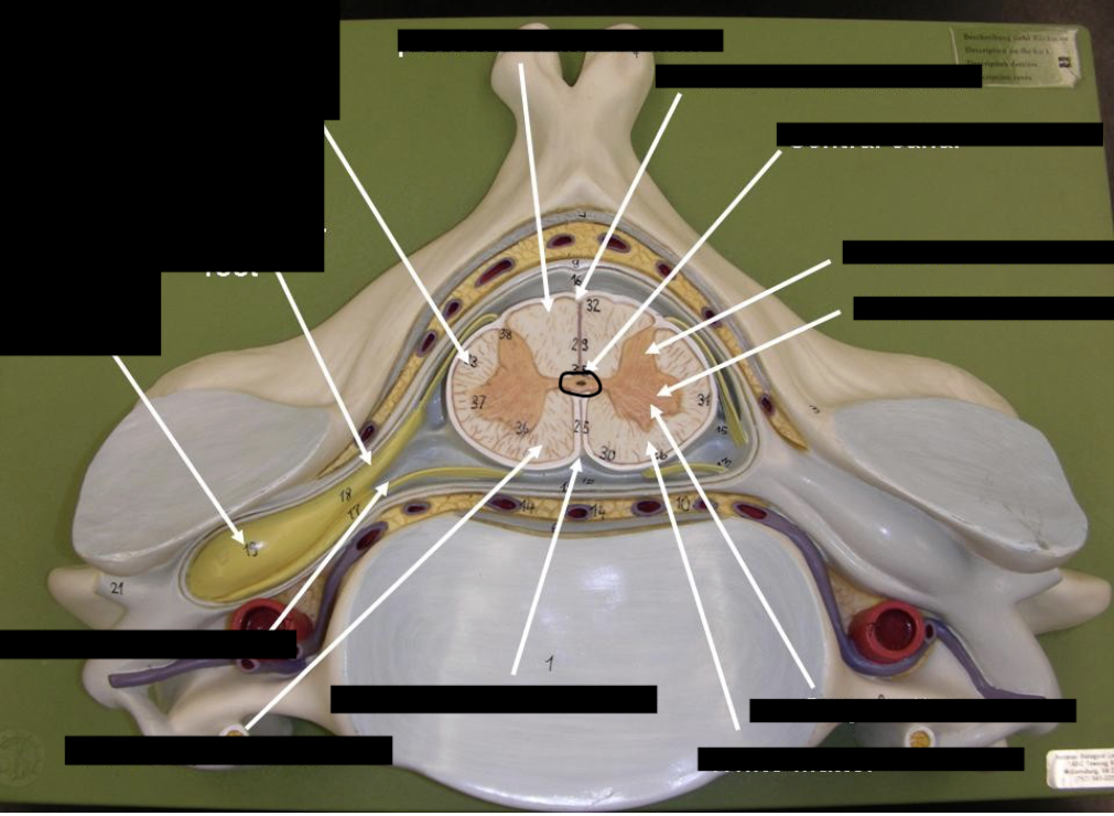 <p>what is this part of the vertebrae (of the spinal cord?)</p>