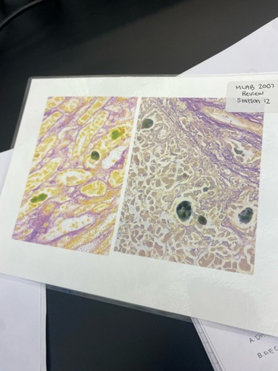 <p>What stain is this?</p>