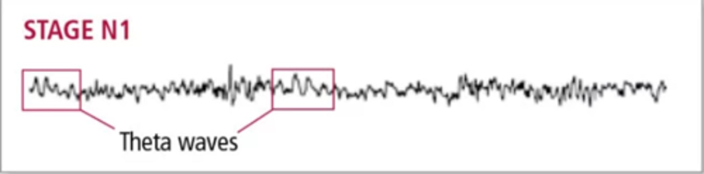 <p>(A) N1</p><p>N1 is the sleep stage between sleep and wakefulness. This stage of sleep produces Theta Waves, and one may experience hypnagonic hallucinations (imagining things that are not there), or hypnic jerks (feeling of falling).</p>