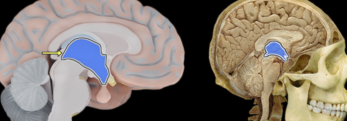 <p>Third ventricle</p>