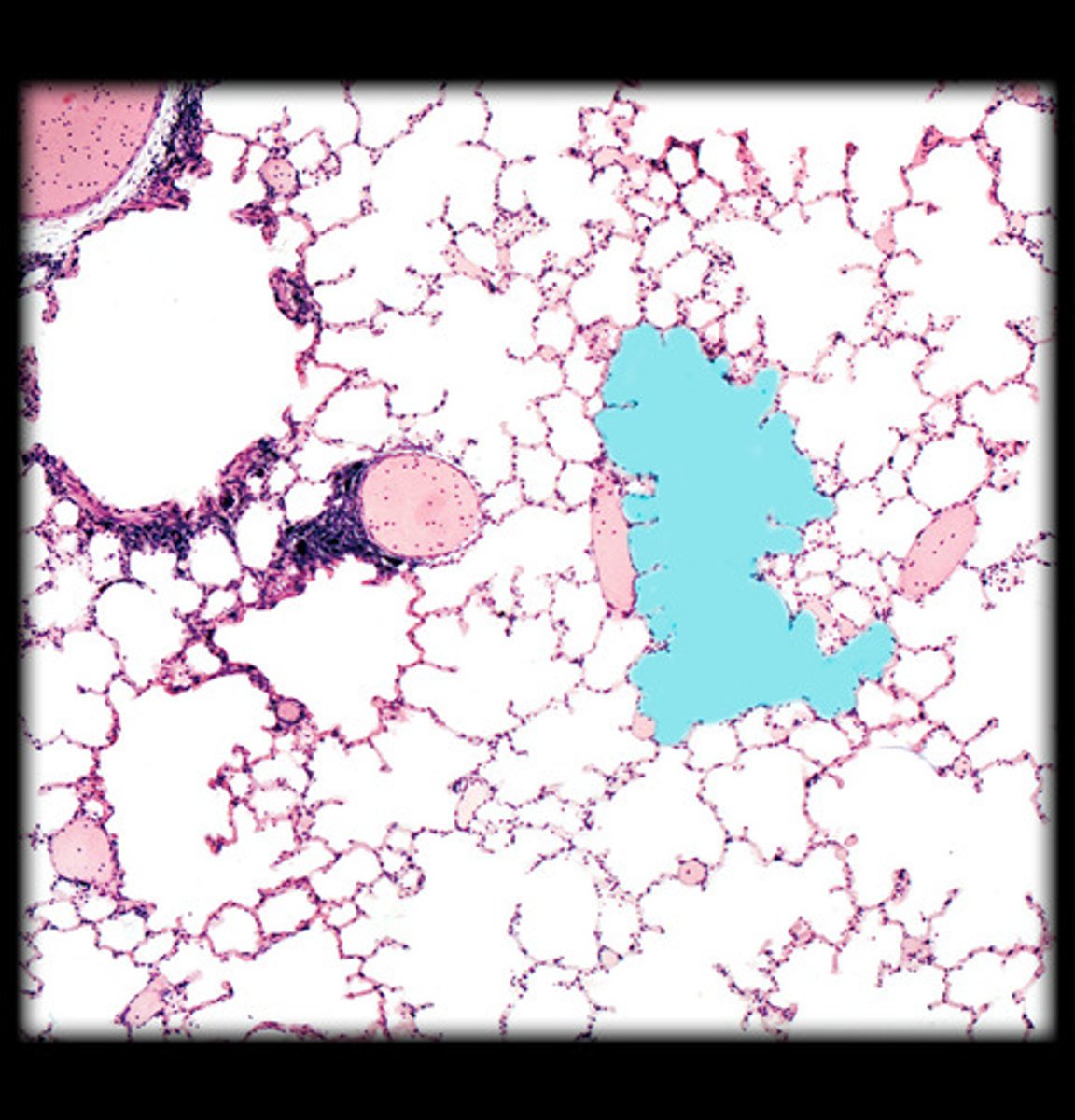 <p>what is highlighted HM in this image?</p>