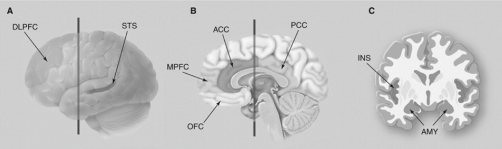 <p><strong>Insula cortex</strong> and the <strong>dorsolateral prefrontal cortex</strong>. The <strong>insula</strong> is predominantly involved in <strong>negative emotional states</strong>, such as <strong>anger</strong> and <strong>disgust</strong>. So even though the <strong>rational brain</strong>—perhaps the prefrontal cortex—should be telling participants to accept any offer (since something is better than nothing), the <strong>insula</strong> gets in the way. In this sense, the emotional response can <strong>override</strong> the cognitive one and determine how the decision is made.</p>