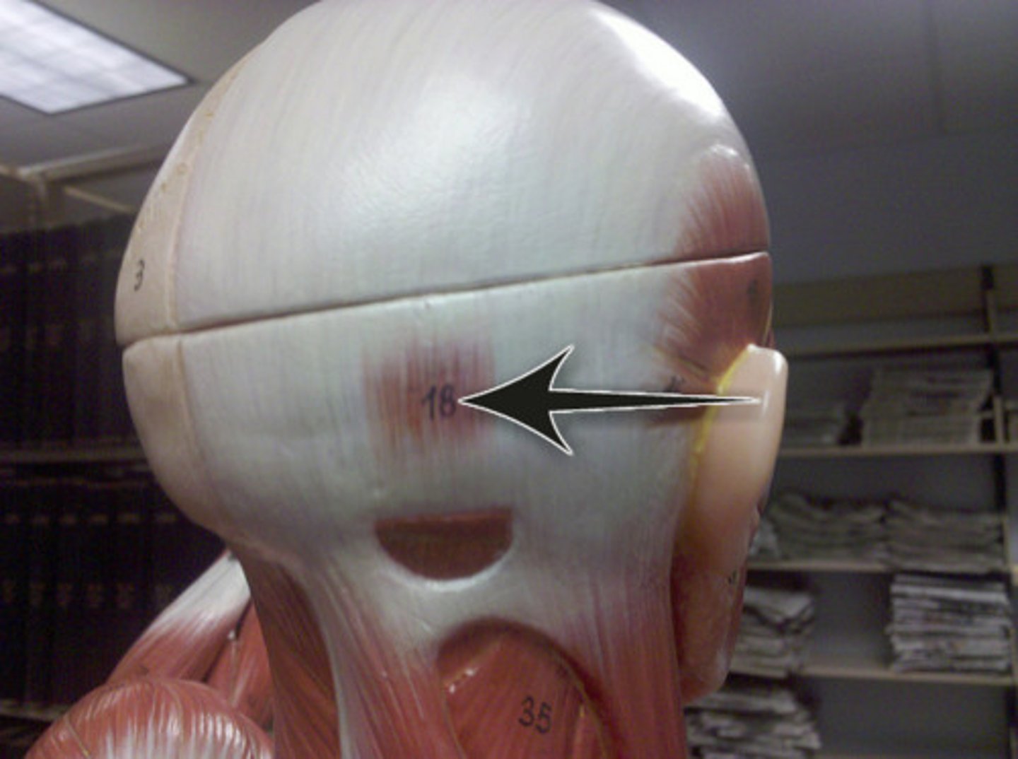 <p>Draws scalp posteriorly</p>