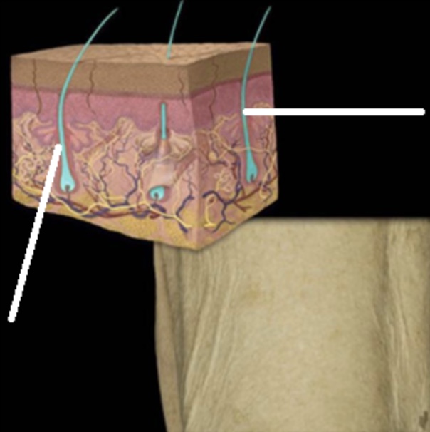 <p>Which accessory structure is highlighted in the picture?</p><p>Sebaceous</p><p>Piloerector</p><p>Dermis</p><p>Hypodermis</p><p>Hair</p>