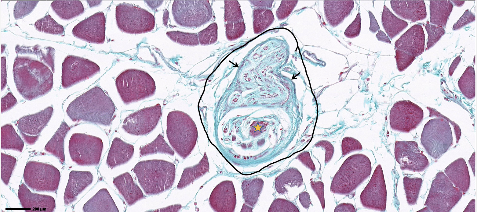 <ol><li><p>ID the entire structure within the circle and where is this structure found?</p></li><li><p>ID the cell with the orange star</p></li><li><p>ID the structure at the tip of the black arrow</p></li></ol>