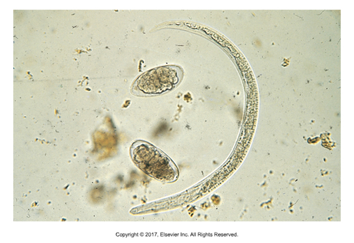 <p>Ruminant lungworm - "Netlike stalk"</p><ul><li><p>Found: Worldwide​</p></li><li><p>Cause of infection: Ingestion of infective larvae​</p></li><li><p>Adults live in bronchi, females lay eggs in lungs, coughed up, swallowed and hatch in intestine, larvae mature in environment to infective stage​</p></li><li><p>Ingested larvae migrate to lymphatics, then to the heart, then to the lungs where they mature ​</p></li><li><p>Coughing is most common symptom​</p></li><li><p>Eggs can be found in sputum​</p></li><li><p>Larvae can be found in fecals</p></li></ul><p></p>