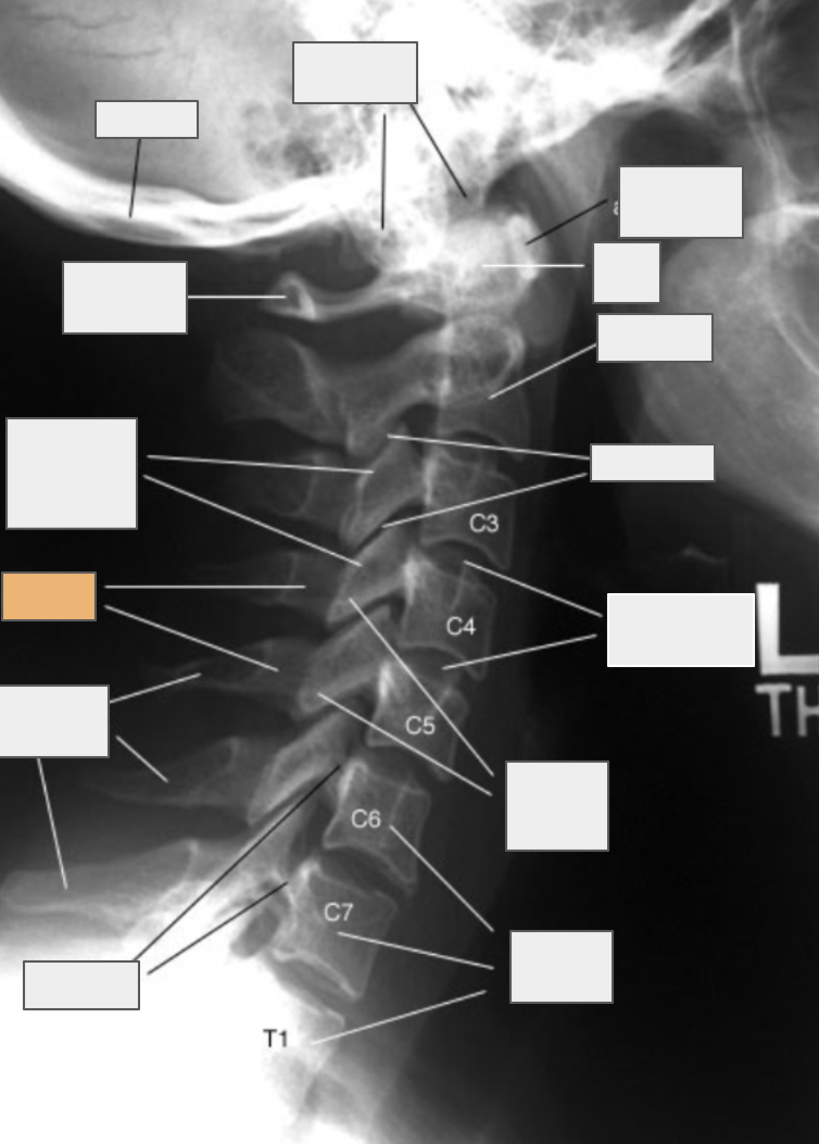 <p>What structure of the spine does the box highlighted in orange reference to?</p>