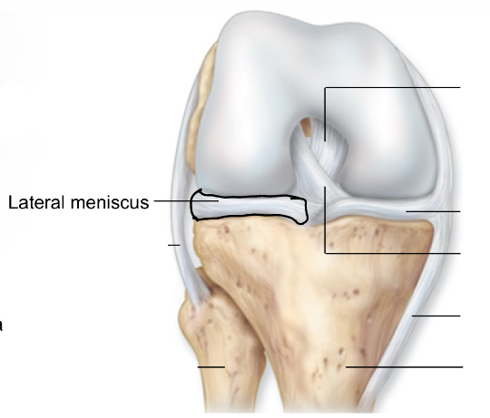 <p>lateral meniscus</p>