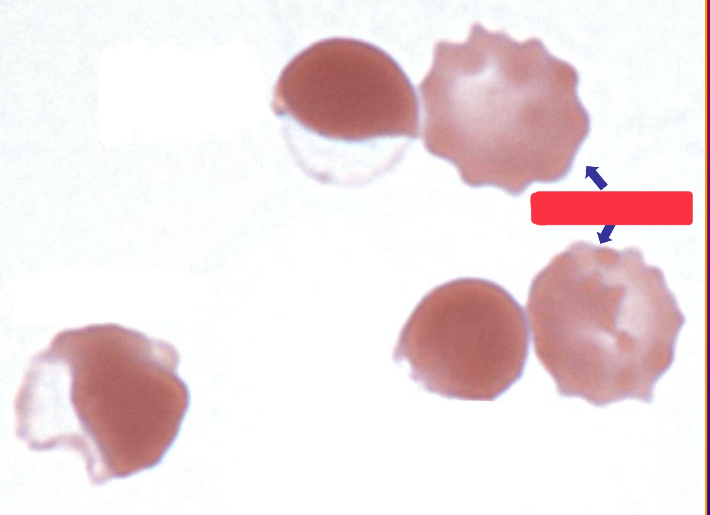 <p>What are these cells?</p>