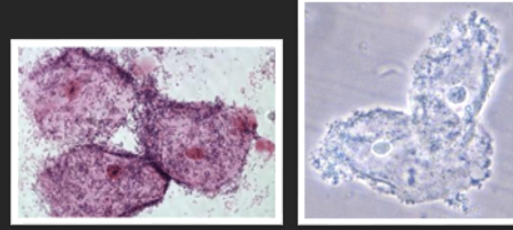 <p>What are these? What are they associated with?</p>